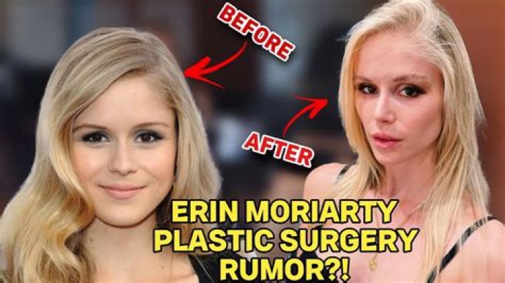 The Truth About Erin Moriarty Plastic Surgery